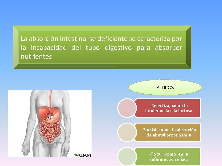 La absorción intestinal se deficiente se caracteriza por la incapacidad del tubo digestivo para