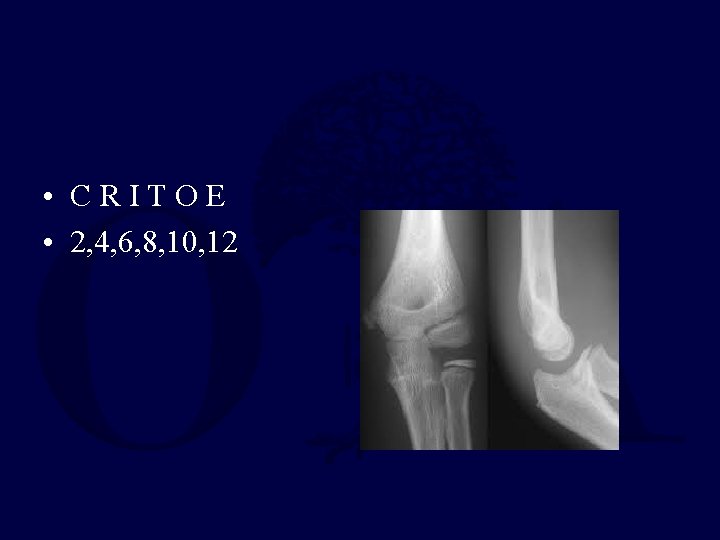  • CRITOE • 2, 4, 6, 8, 10, 12 