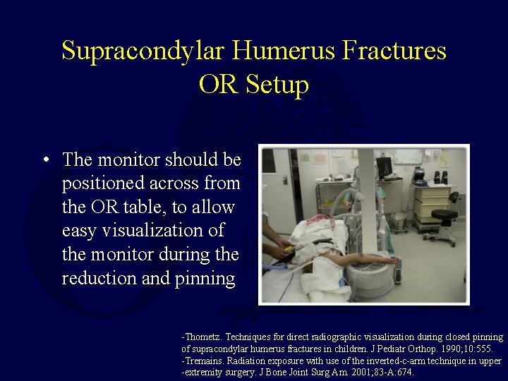 Supracondylar Humerus Fractures OR Setup • The monitor should be positioned across from the