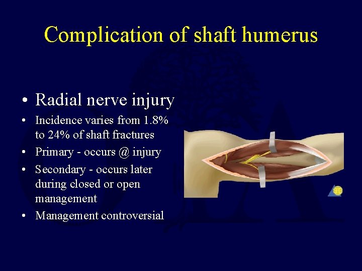 Complication of shaft humerus • Radial nerve injury • Incidence varies from 1. 8%