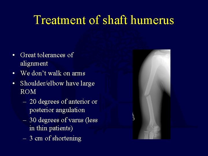Treatment of shaft humerus • Great tolerances of alignment • We don’t walk on