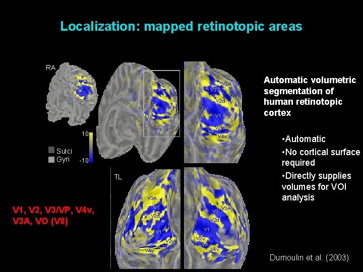 Localization: mapped retinotopic areas RA V 3 V 2 d V 1 VP 10