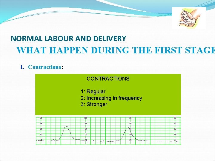 NORMAL LABOUR AND DELIVERY WHAT HAPPEN DURING THE FIRST STAGE 1. Contractions: CONTRACTIONS 1: