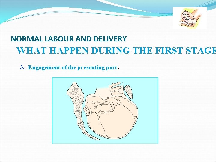 NORMAL LABOUR AND DELIVERY WHAT HAPPEN DURING THE FIRST STAGE 3. Engagement of the