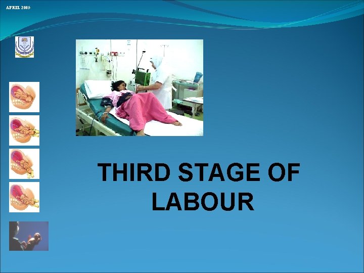 APRIL 2005 THIRD STAGE OF LABOUR 