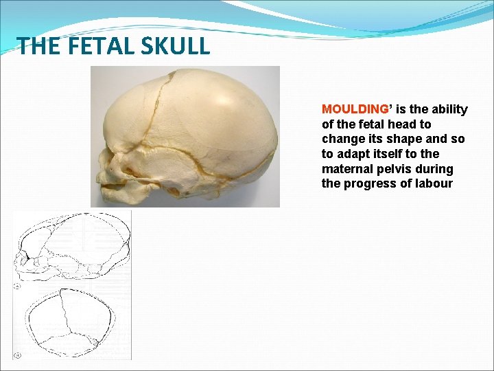 THE FETAL SKULL MOULDING’ is the ability of the fetal head to change its