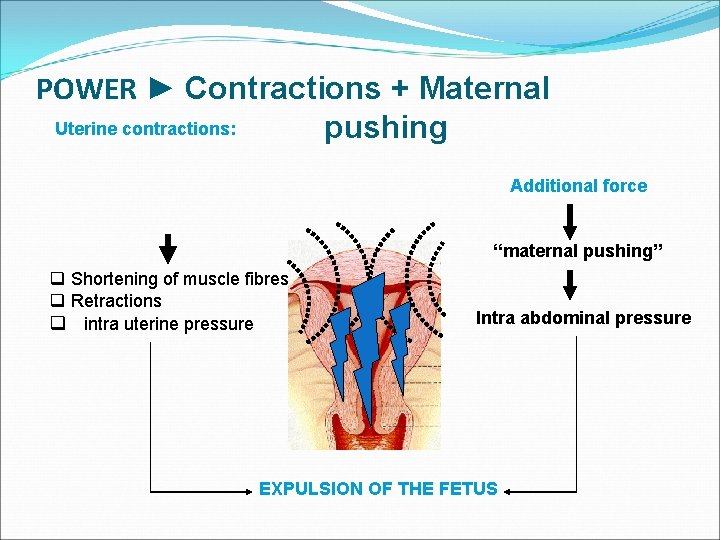 POWER ► Contractions + Maternal Uterine contractions: pushing Additional force “maternal pushing” q Shortening