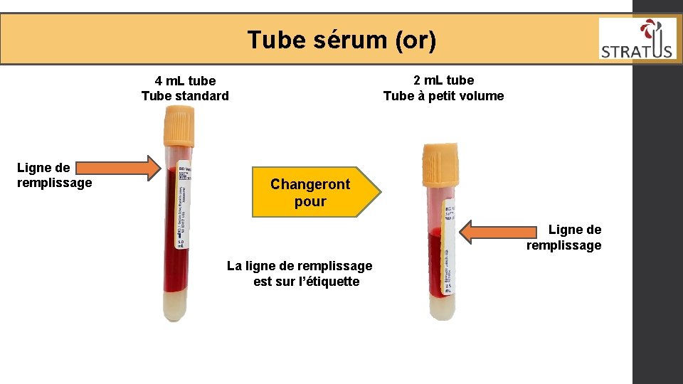 Tube sérum (or) 2 m. L tube Tube à petit volume 4 m. L