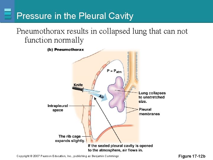 Pressure in the Pleural Cavity Pneumothorax results in collapsed lung that can not function