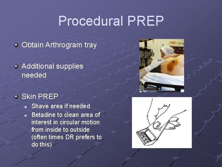 Procedural PREP Obtain Arthrogram tray Additional supplies needed Skin PREP n n Shave area