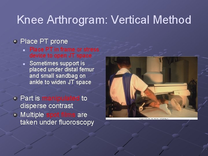 Knee Arthrogram: Vertical Method Place PT prone n n Place PT in frame or