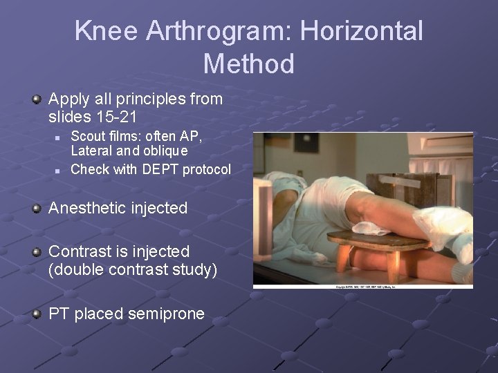 Knee Arthrogram: Horizontal Method Apply all principles from slides 15 -21 n n Scout