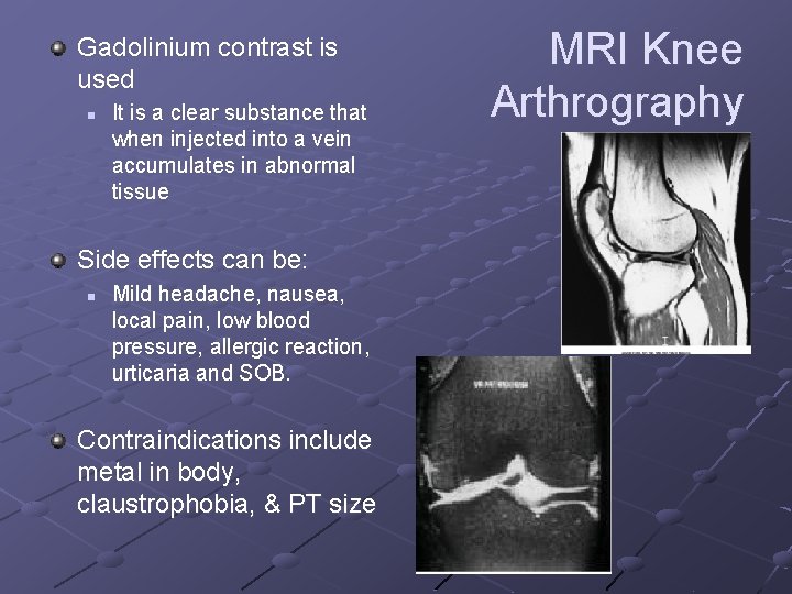 Gadolinium contrast is used n It is a clear substance that when injected into