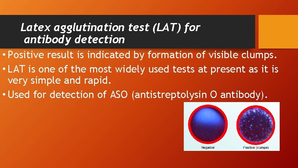 Latex agglutination test (LAT) for antibody detection • Positive result is indicated by formation