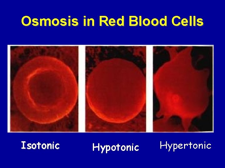 Osmosis in Red Blood Cells Isotonic Hypertonic 