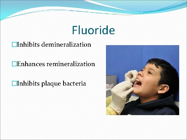 Fluoride �Inhibits demineralization �Enhances remineralization �Inhibits plaque bacteria 