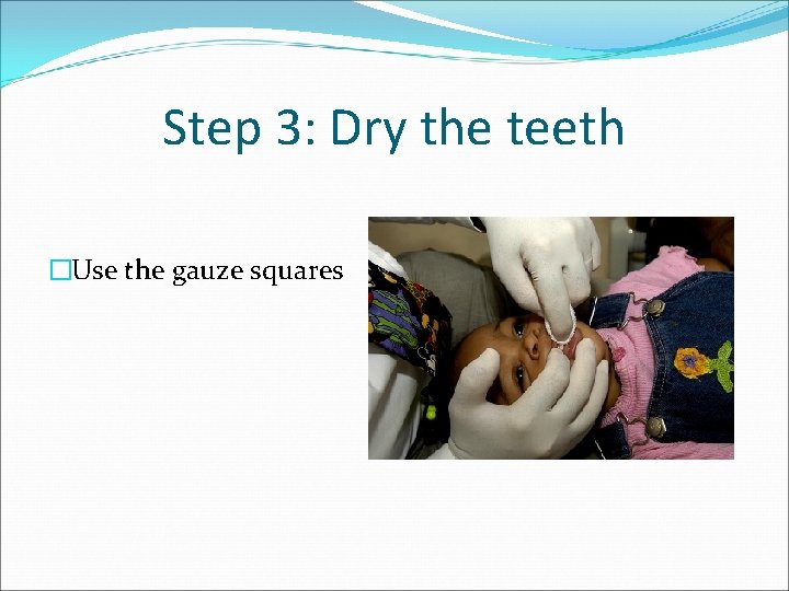 Step 3: Dry the teeth �Use the gauze squares 