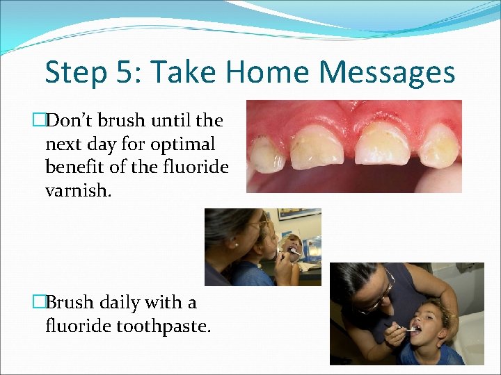 Step 5: Take Home Messages �Don’t brush until the next day for optimal benefit