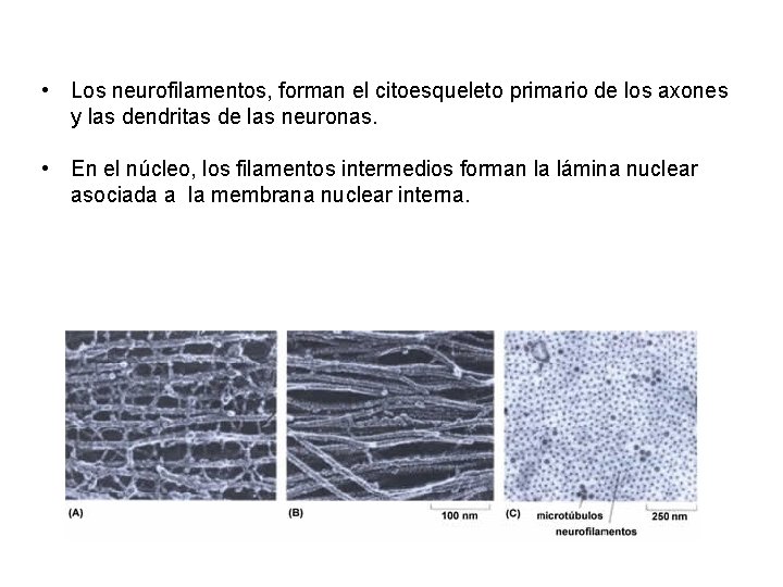  • Los neurofilamentos, forman el citoesqueleto primario de los axones y las dendritas