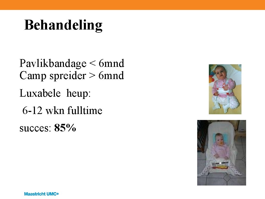 Behandeling Pavlikbandage < 6 mnd Camp spreider > 6 mnd Luxabele heup: 6 -12