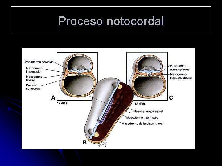 Proceso notocordal 