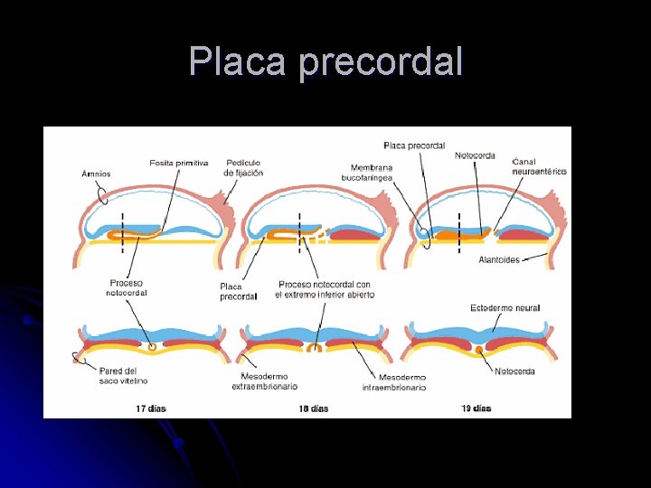 Placa precordal 