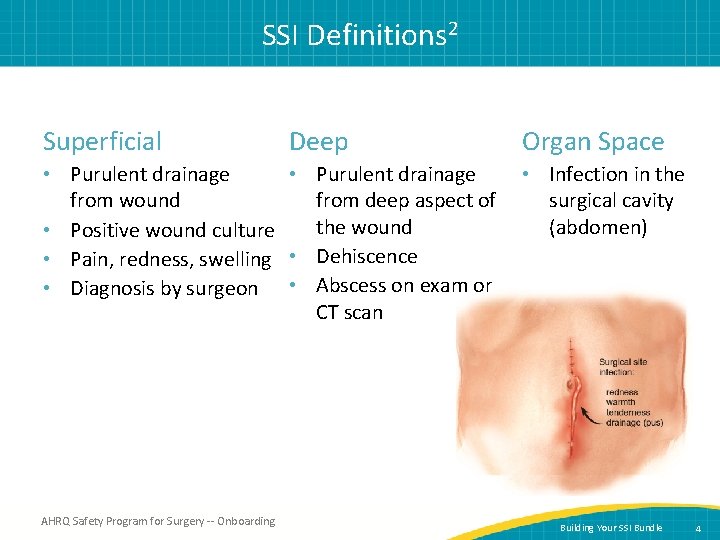 SSI Definitions 2 Superficial Deep Organ Space • Purulent drainage • Infection in the