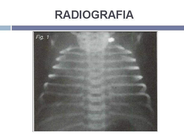 RADIOGRAFIA 