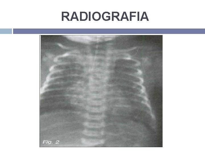 RADIOGRAFIA 