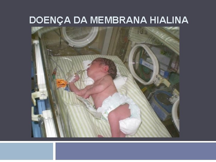DOENÇA DA MEMBRANA HIALINA 