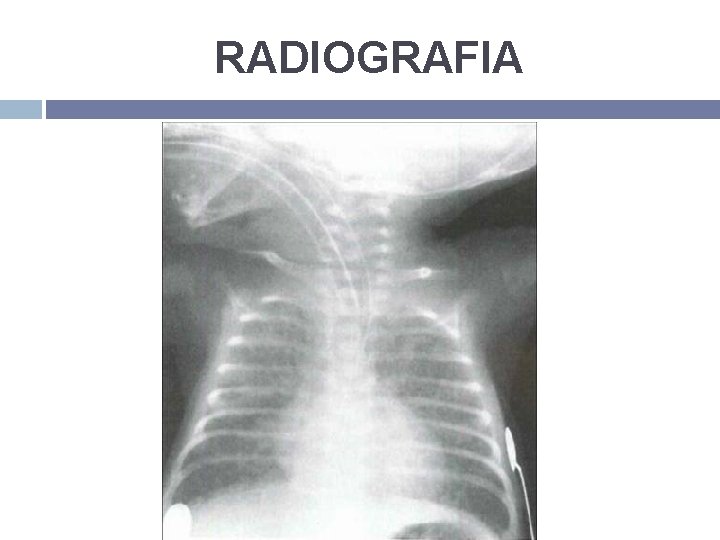 RADIOGRAFIA 
