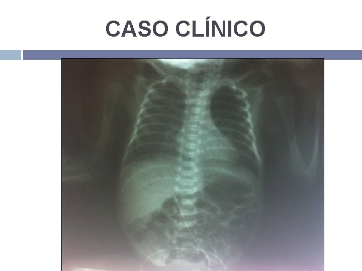 CASO CLÍNICO 