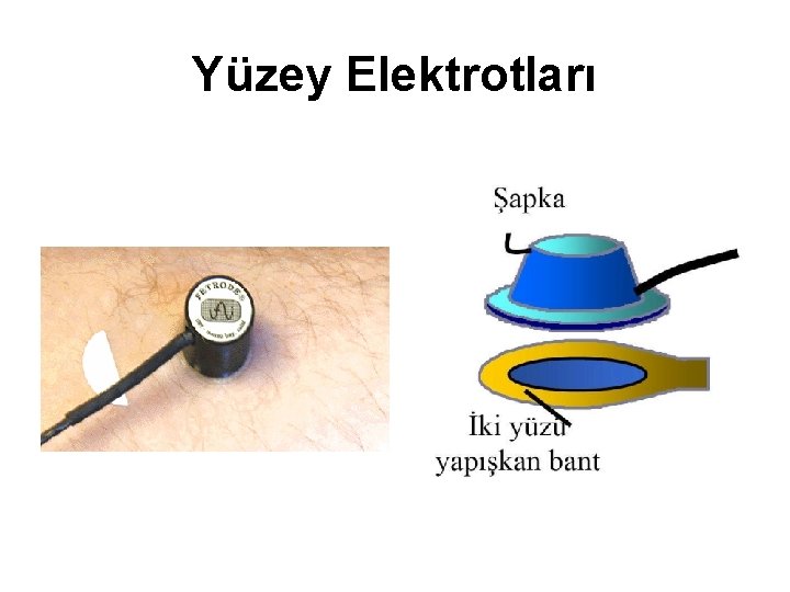 Yüzey Elektrotları 