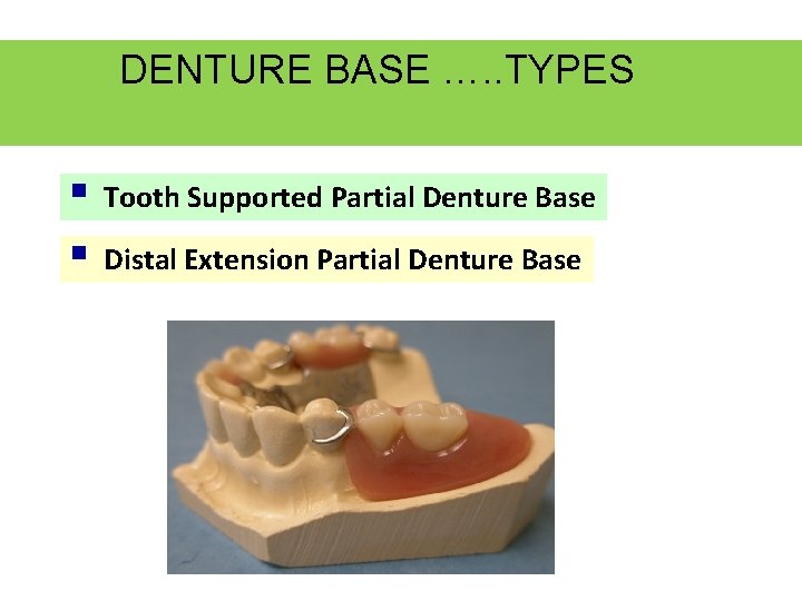 DENTURE BASE …. . TYPES § Tooth Supported Partial Denture Base § Distal Extension