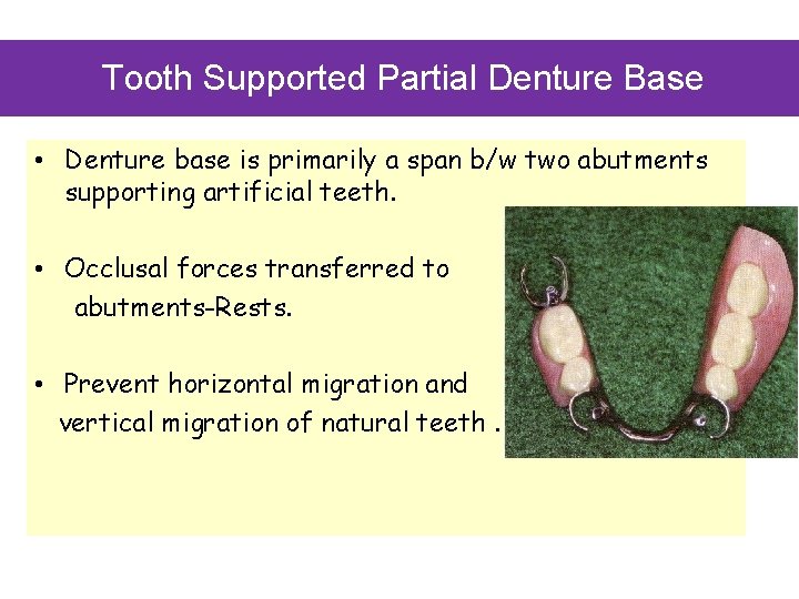 Tooth Supported Partial Denture Base • Denture base is primarily a span b/w two
