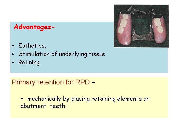 Advantages • Esthetics, • Stimulation of underlying tissue • Relining Primary retention for RPD