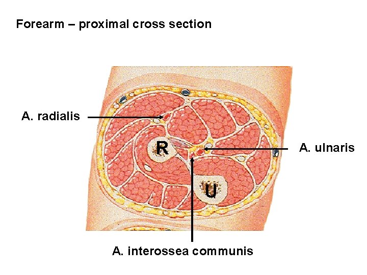 Forearm – proximal cross section A. radialis R A. ulnaris U A. interossea communis