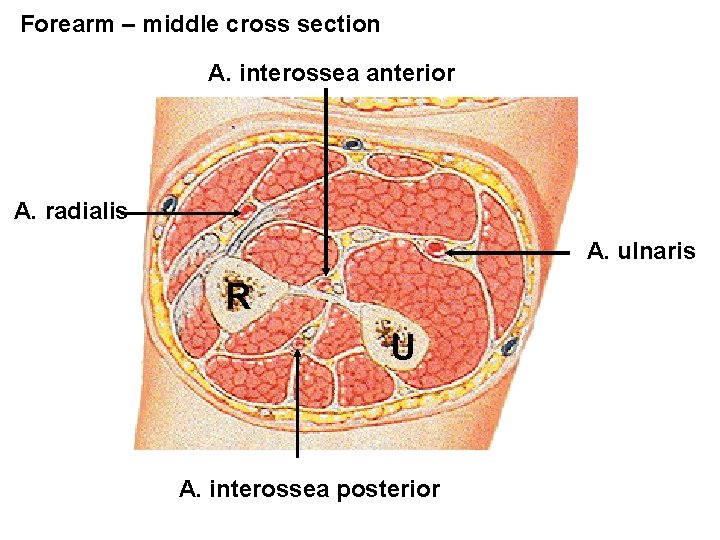 Forearm – middle cross section A. interossea anterior A. radialis A. ulnaris R U