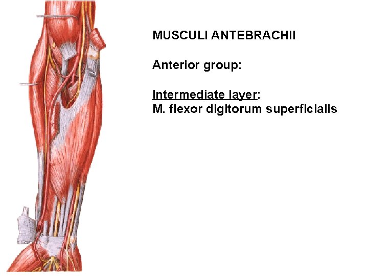 MUSCULI ANTEBRACHII Anterior group: Intermediate layer: M. flexor digitorum superficialis 