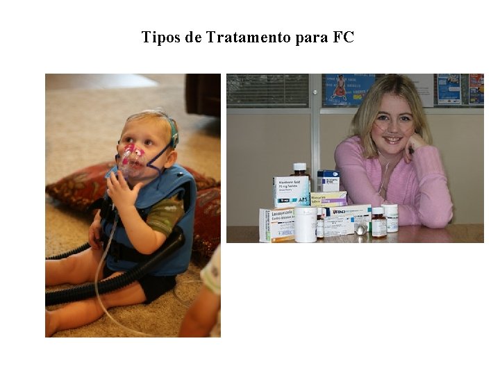Tipos de Tratamento para FC 