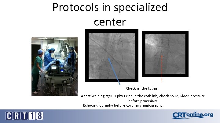 Protocols in specialized center Check all the tubes Anesthesiologist/ICU physician in the cath lab,