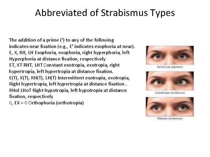 Abbreviated of Strabismus Types The addition of a prime (') to any of the Abbreviated of Strabismus Types The addition of a prime (') to any of the