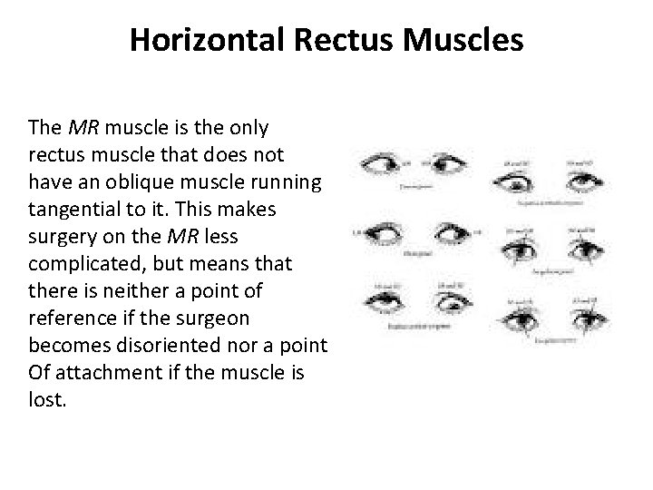 Horizontal Rectus Muscles The MR muscle is the only rectus muscle that does not Horizontal Rectus Muscles The MR muscle is the only rectus muscle that does not