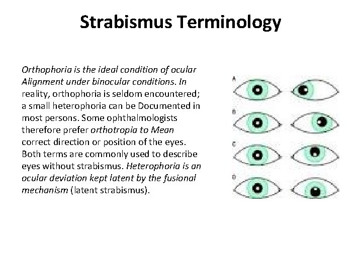 Strabismus Terminology Orthophoria is the ideal condition of ocular Alignment under binocular conditions. In Strabismus Terminology Orthophoria is the ideal condition of ocular Alignment under binocular conditions. In