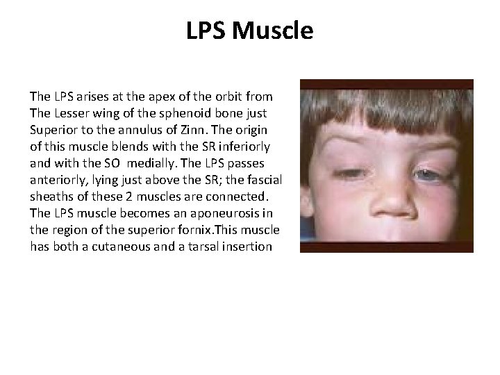 LPS Muscle The LPS arises at the apex of the orbit from The Lesser LPS Muscle The LPS arises at the apex of the orbit from The Lesser