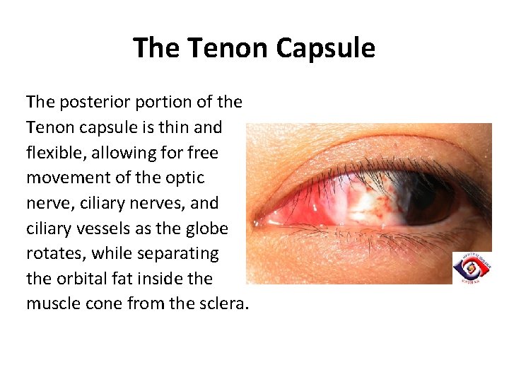 The Tenon Capsule The posterior portion of the Tenon capsule is thin and flexible, The Tenon Capsule The posterior portion of the Tenon capsule is thin and flexible,