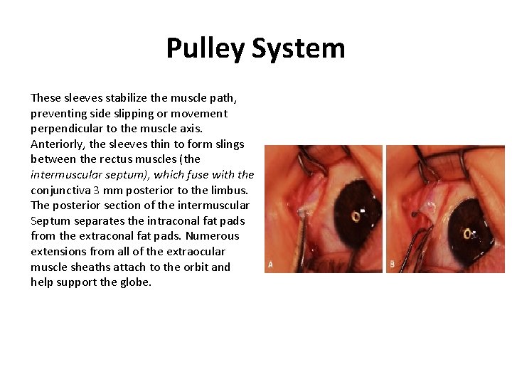 Pulley System These sleeves stabilize the muscle path, preventing side slipping or movement perpendicular Pulley System These sleeves stabilize the muscle path, preventing side slipping or movement perpendicular