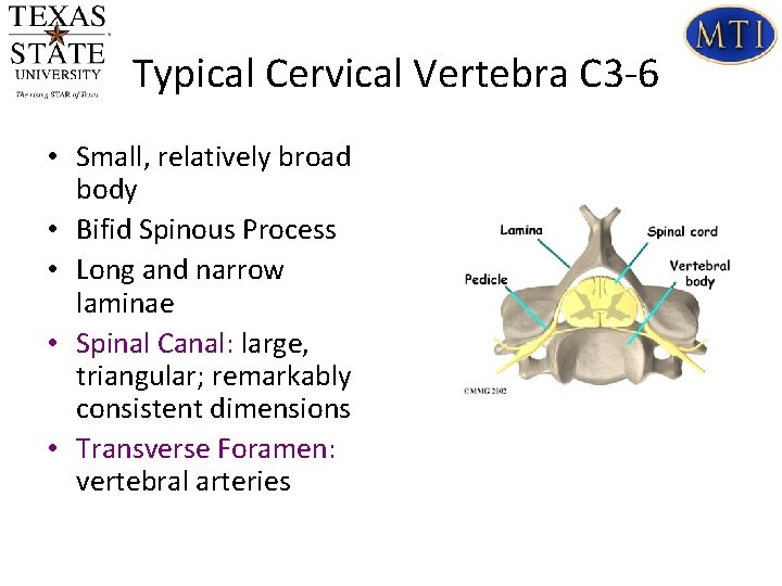 Typical Cervical Vertebra C 3 -6 • Small, relatively broad body • Bifid Spinous