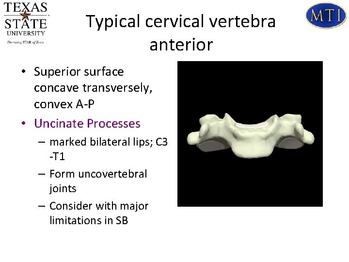 Typical cervical vertebra anterior • Superior surface concave transversely, convex A-P • Uncinate Processes