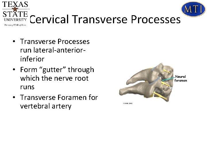 Cervical Transverse Processes • Transverse Processes run lateral-anteriorinferior • Form “gutter” through which the